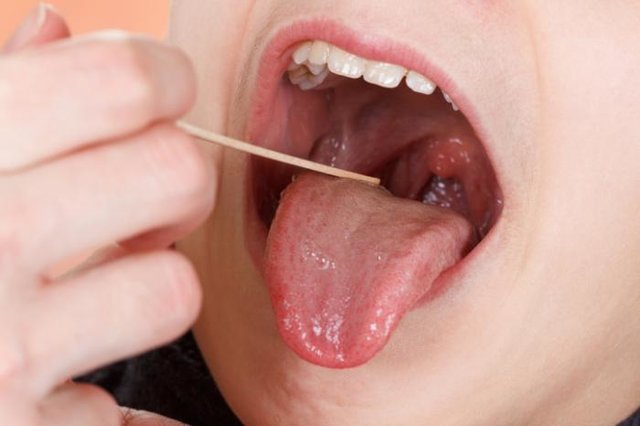 نقش لوزه‌ها در سیستم ایمنی بدن لو رفت