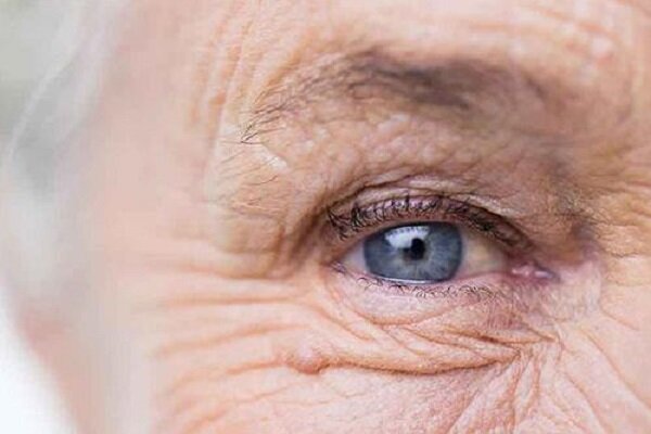 پیرچشمی چیست؟
