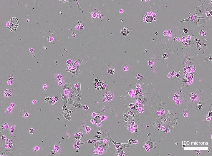 «قیچی ژنتیکی» جدید DNA را نصف کرد