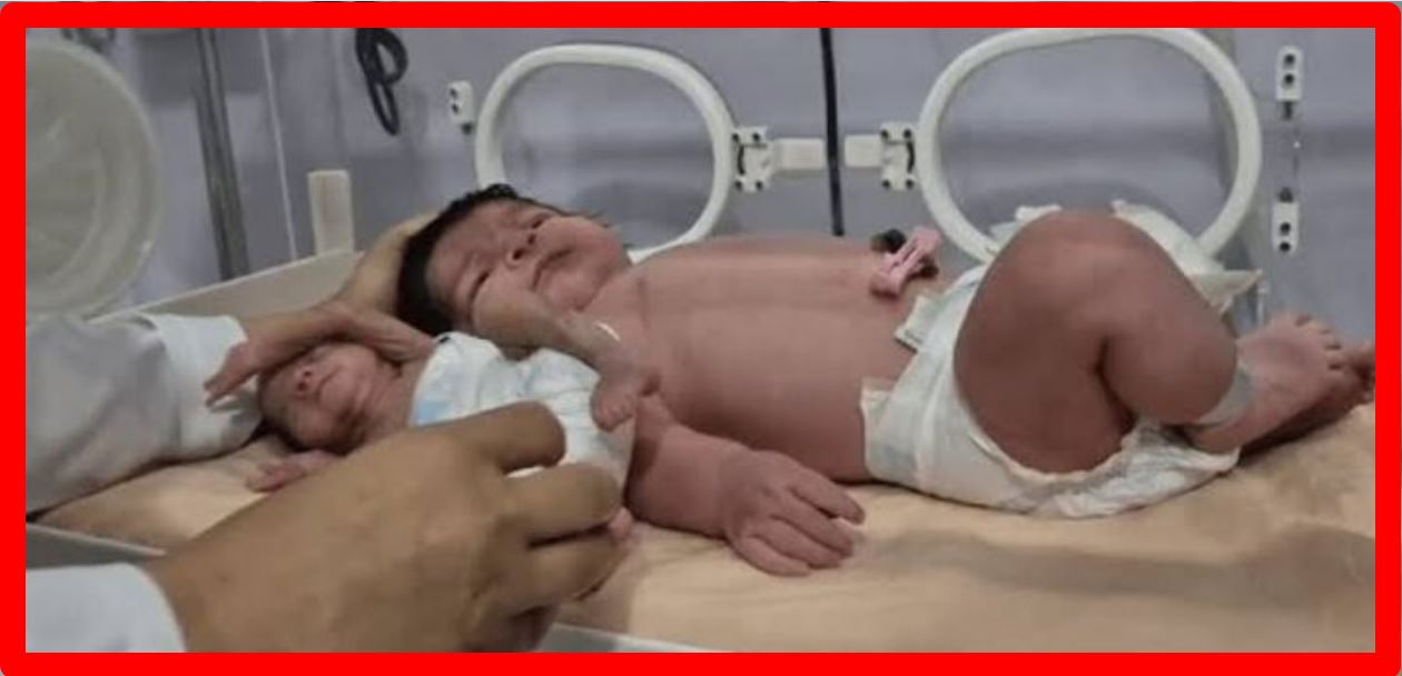 تولد نوزادی نزدیک به 6 کیلو در بندرعباس+ عکس