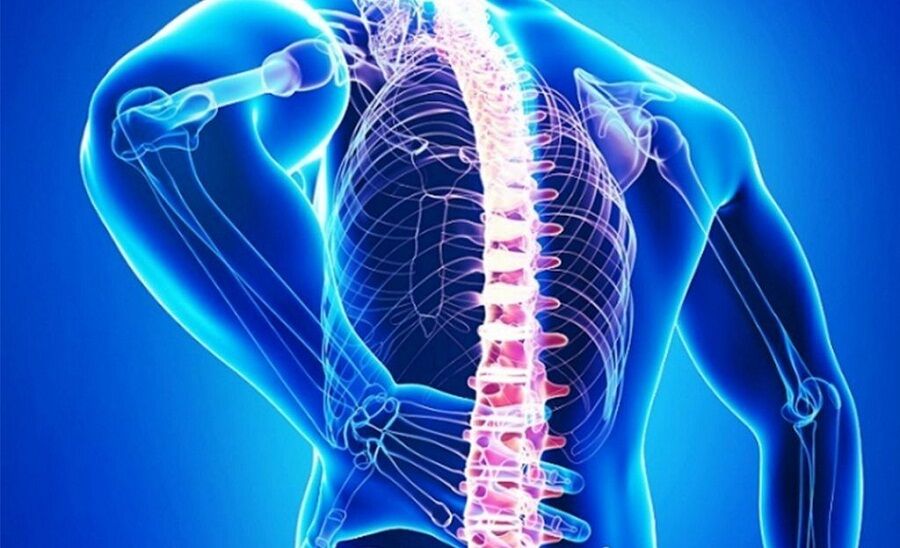 جراحی ستون فقرات با هوش مصنوعی و پرینت سه‌بعدی؛ انقلابی که از یک ایرانی آغاز شد